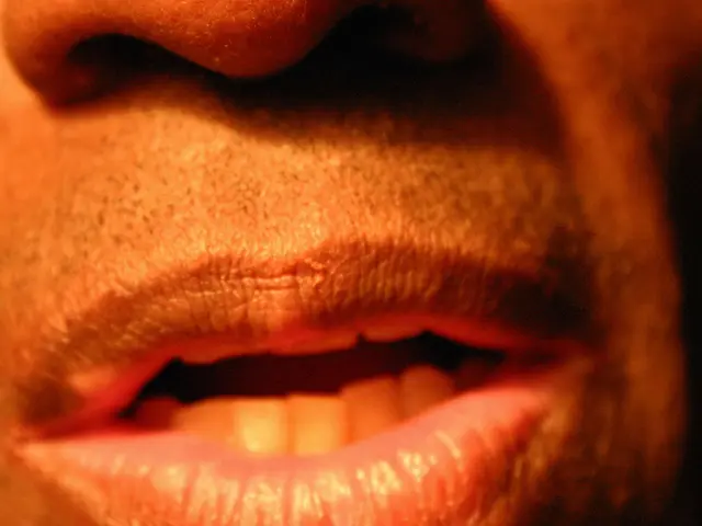 Rare instance of a posterior superior alveolar artery anomaly on the maxillary sinus floor detected...