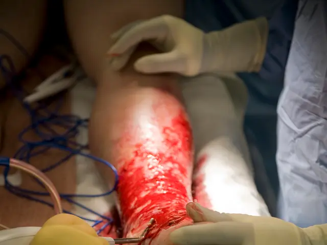 The image shows a person wearing gloves and holding a pair of scissors while performing surgery on...