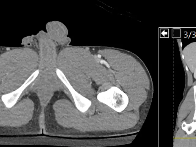 The image shows a ct scan of a patient's lungs, providing a detailed view of the anatomy of the...
