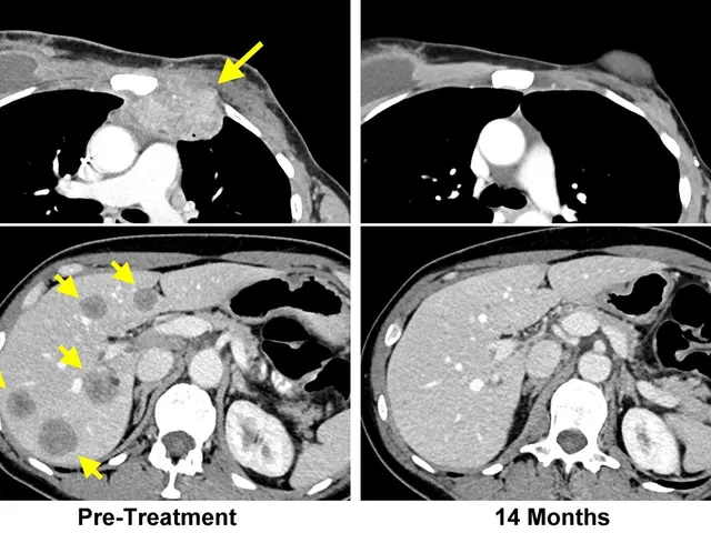 The image shows a ct scan of a patient's chest with a yellow arrow pointing to the left and a black...