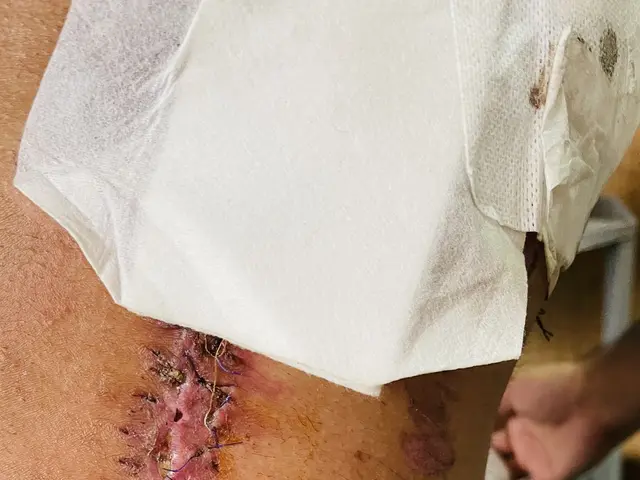 The image shows a man in a hospital bed with a bandage on his leg, and a scar on his stomach. In...
