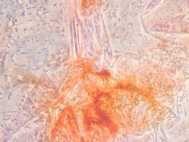 The image shows a close up of a piece of paper with a small amount of blood on it, which appears to...
